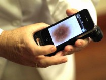 Primera pantalla inalámbrica: Teléfono móvil que diagnostica cáncer